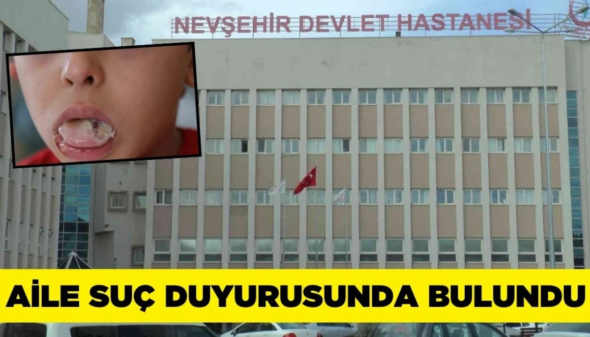 Ameliyatta Akılalmaz İhmal: 5 Yaşındaki Çocuğun Dili ve Dudağı Yandı