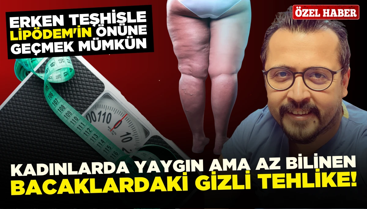 Kadın Sağlığında Görünmeyen Tehdit: Lipödem