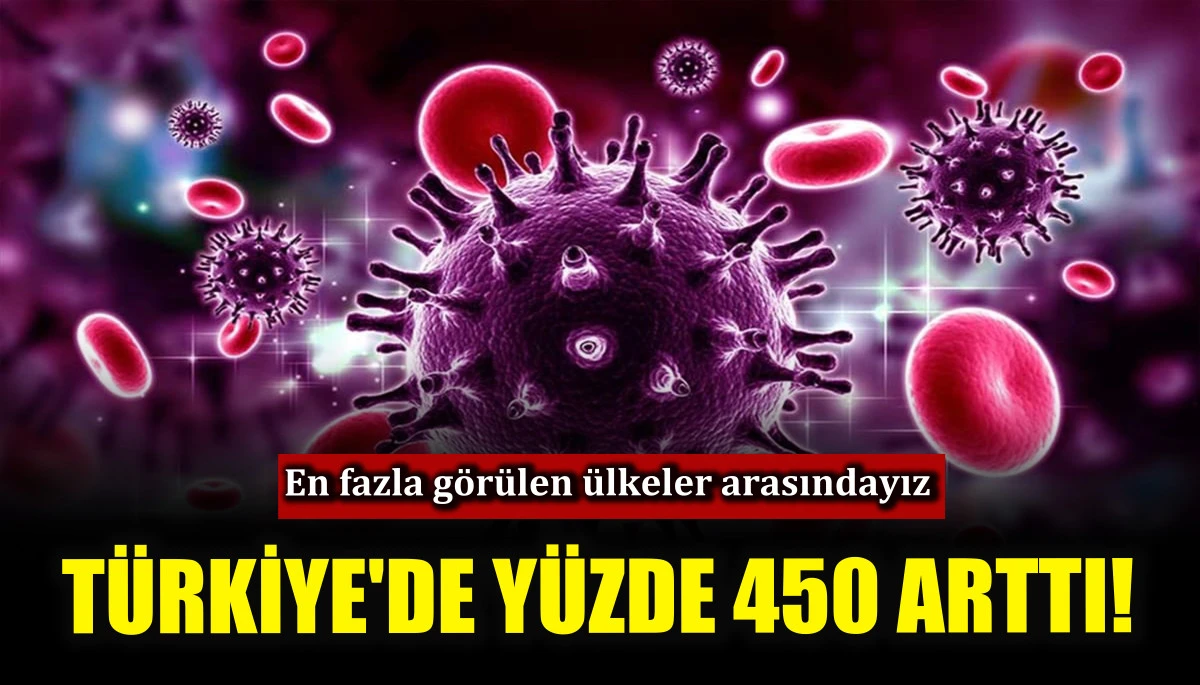 HIV enfeksiyonu T&uuml;rkiye'de y&uuml;zde 450 arttı!