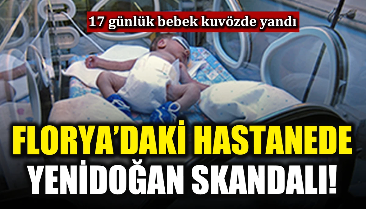 Yenidoğan skandalı: 17 g&uuml;nl&uuml;k bebek kuv&ouml;zde yandı